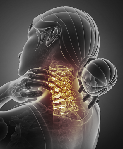 Cervical Conditions